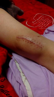 脚心痒是怎么回事(两个脚心痒是怎么回事),第3张 脚心痒是怎么回事(两个脚心痒是怎么回事),脚心痒是怎么回事(两个脚心痒是怎么回事),第3张