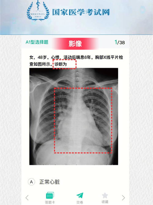 q6(q6h医学上是什么意思),第3张 q6(q6h医学上是什么意思),q6(q6h医学上是什么意思),第3张