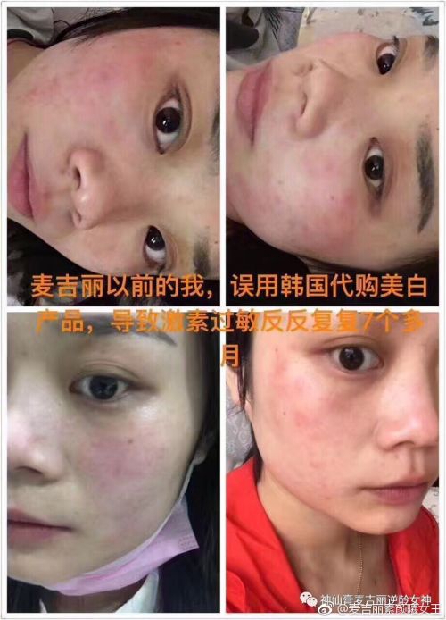 石菖蒲的功效与作用及食用方法(石菖蒲的功效与作用及食用方法石菖蒲的除草药能有用吗),第2张 石菖蒲的功效与作用及食用方法(石菖蒲的功效与作用及食用方法石菖蒲的除草药能有用吗),石菖蒲的功效与作用及食用方法(石菖蒲的功效与作用及食用方法石菖蒲的除草药能有用吗),第2张