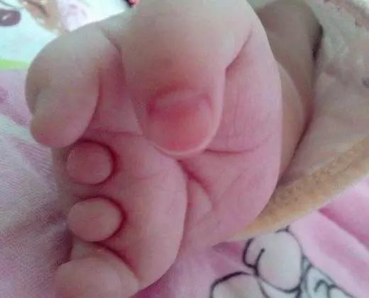 猴头菇孕妇能吃吗(猴头菇孕妇吃了胎儿畸形),第2张 猴头菇孕妇能吃吗(猴头菇孕妇吃了胎儿畸形),猴头菇孕妇能吃吗(猴头菇孕妇吃了胎儿畸形),第2张