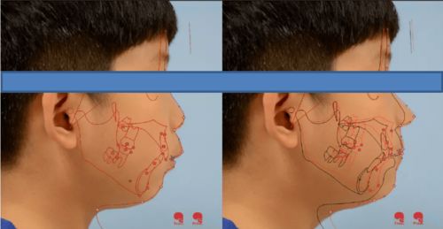 玉米馅饼(玉米馅饼图片),第3张 玉米馅饼(玉米馅饼图片),玉米馅饼(玉米馅饼图片),第3张