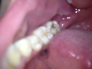 孕妇怎么去火(孕妇怎么去火,嗓子发炎),第1张 孕妇怎么去火(孕妇怎么去火,嗓子发炎),孕妇怎么去火(孕妇怎么去火,嗓子发炎),第1张